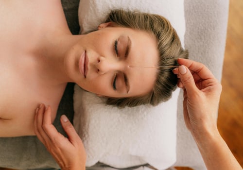 The Healing Power of Acupuncture for Dizziness